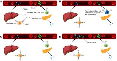 Advanced progress of the relationship between PCSK9 monoclonal antibodies and hyperglycemic adverse events